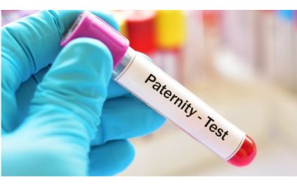 Mu Rwanda hagiye gutangizwa uburyo bwo gupima ADN ku bangavu bamaze ibyumweru bitandatu batwite